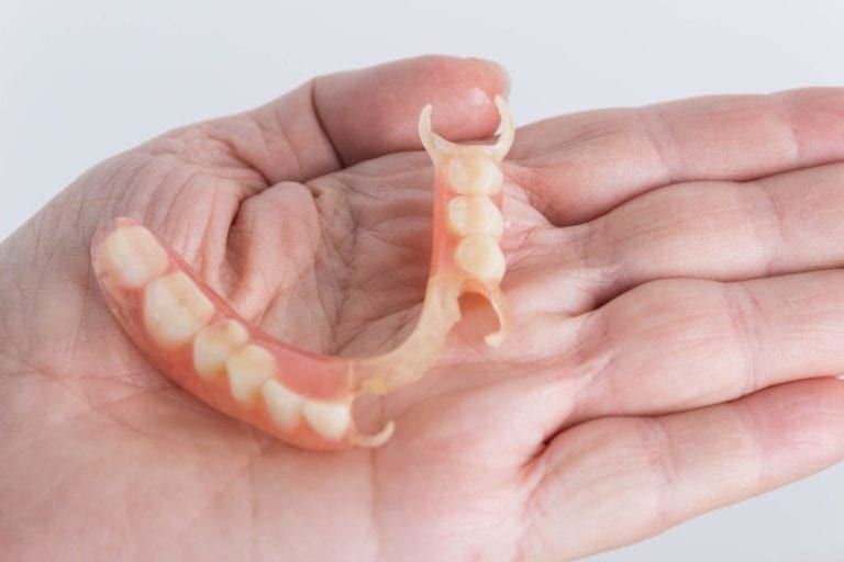 Partial Denture in male hand's palm