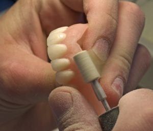 Doctor doing Denture Repair