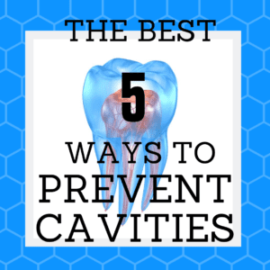 Title Banner for "the best 5 ways to prevent cavities"