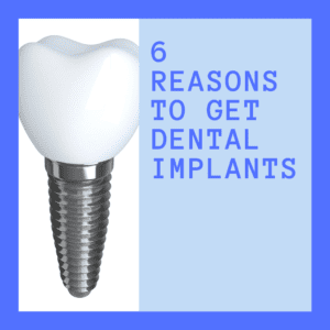 6 Reasons to get dental implants