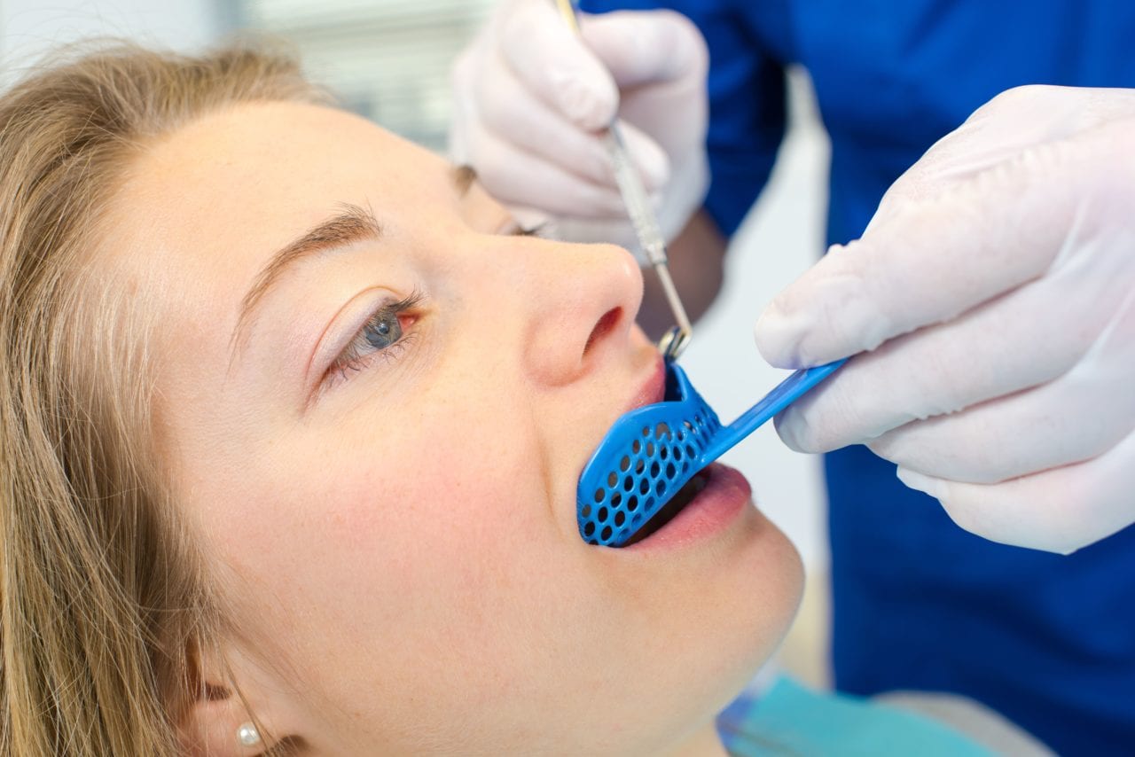 impression dental care